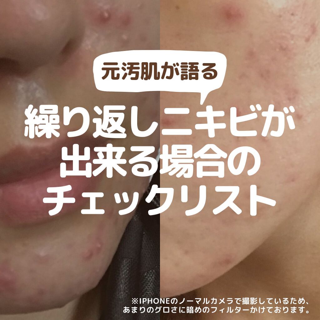 ニベアクリーム/ニベア/ボディクリームを使ったクチコミ(1枚目)