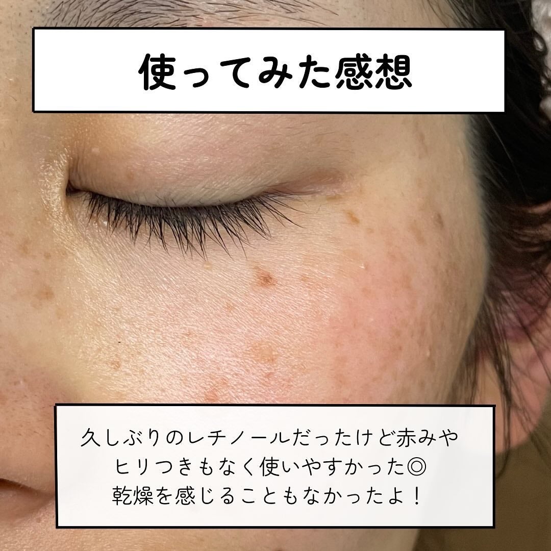 ブラックスネイルレチノールセラム/Dr.G/美容液を使ったクチコミ(5枚目)