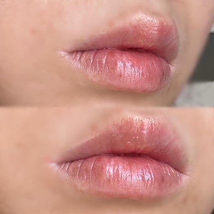 ドトムリッププラスプランパー/keybo/リッププランパーを使ったクチコミ(3枚目)