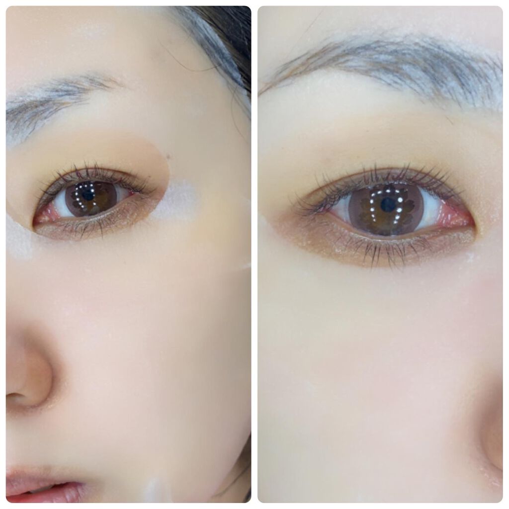 ピンクティーツリーマスクパック/APLIN/シートマスク・パックを使ったクチコミ（3枚目）