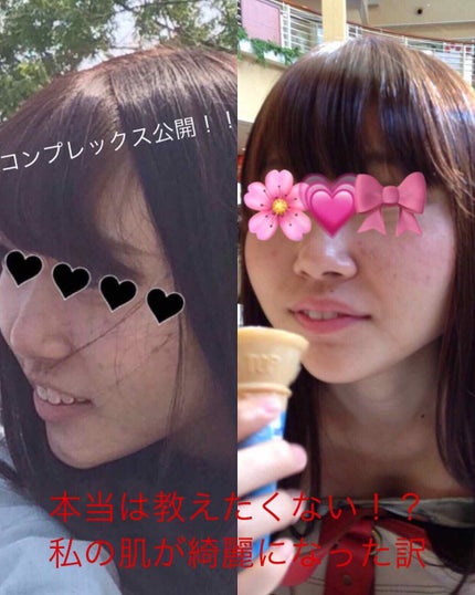ドクタージャルト シカペア クリーム (第2世代)/Dr.Jart+/フェイスクリームを使ったクチコミ(1枚目)