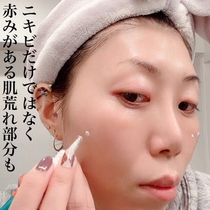 ミラクルアクネクリアスポットトリートメント/SOME BY MI/美容液を使ったクチコミ(5枚目)