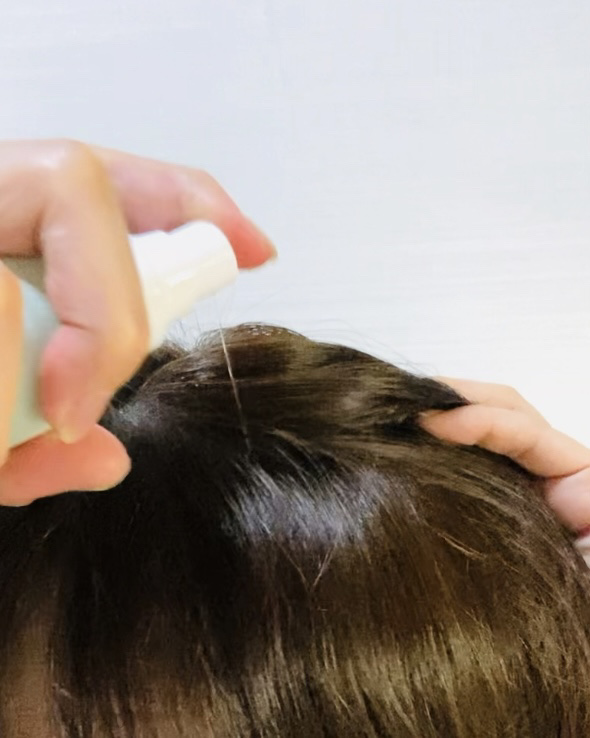 プリミスト ボタニカル育毛剤/Plimist/頭皮ローションを使ったクチコミ（3枚目）