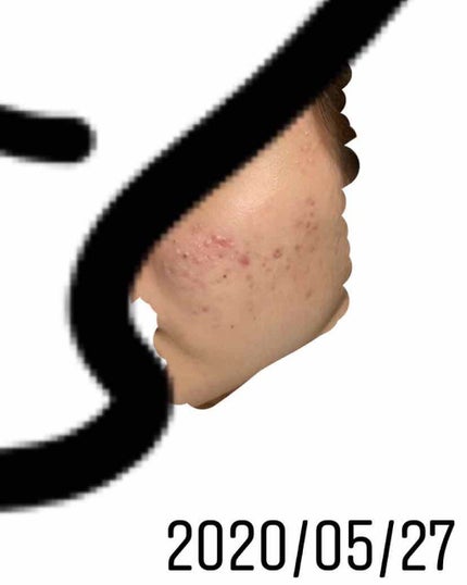 ハトムギ保湿ジェル(ナチュリエ スキンコンディショニングジェル)/ナチュリエ/美容液を使ったクチコミ(3枚目)