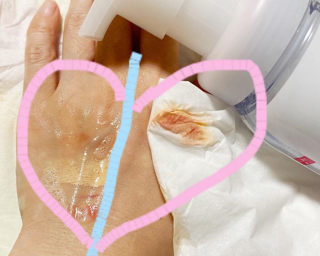 パチパチはたらくメイク落とし/ビオレ/クレンジングウォーターを使ったクチコミ(8枚目)