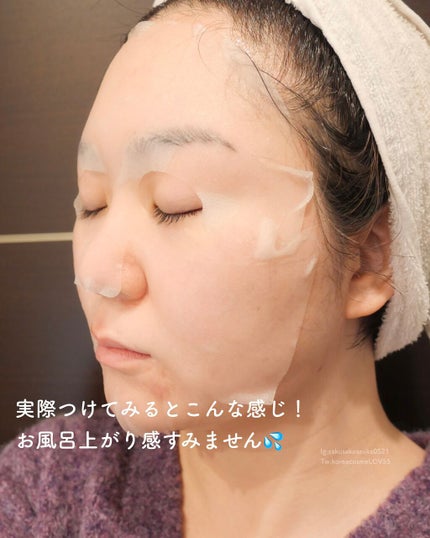 ダーマレーザースーパーVC100マスク/クオリティファースト/シートマスク・パックを使ったクチコミ(4枚目)