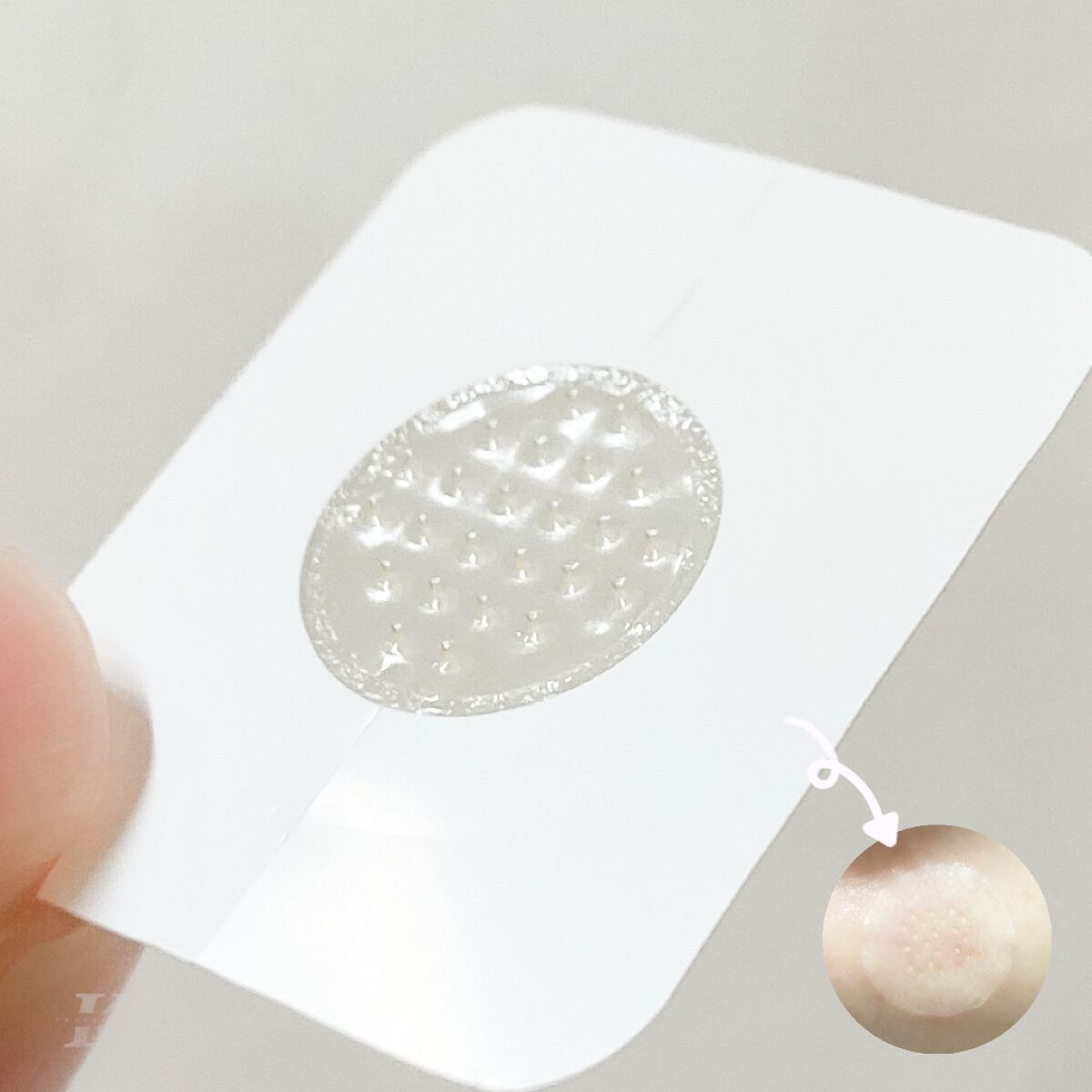 ACケア/ACROPASS/その他スキンケアを使ったクチコミ（3枚目）