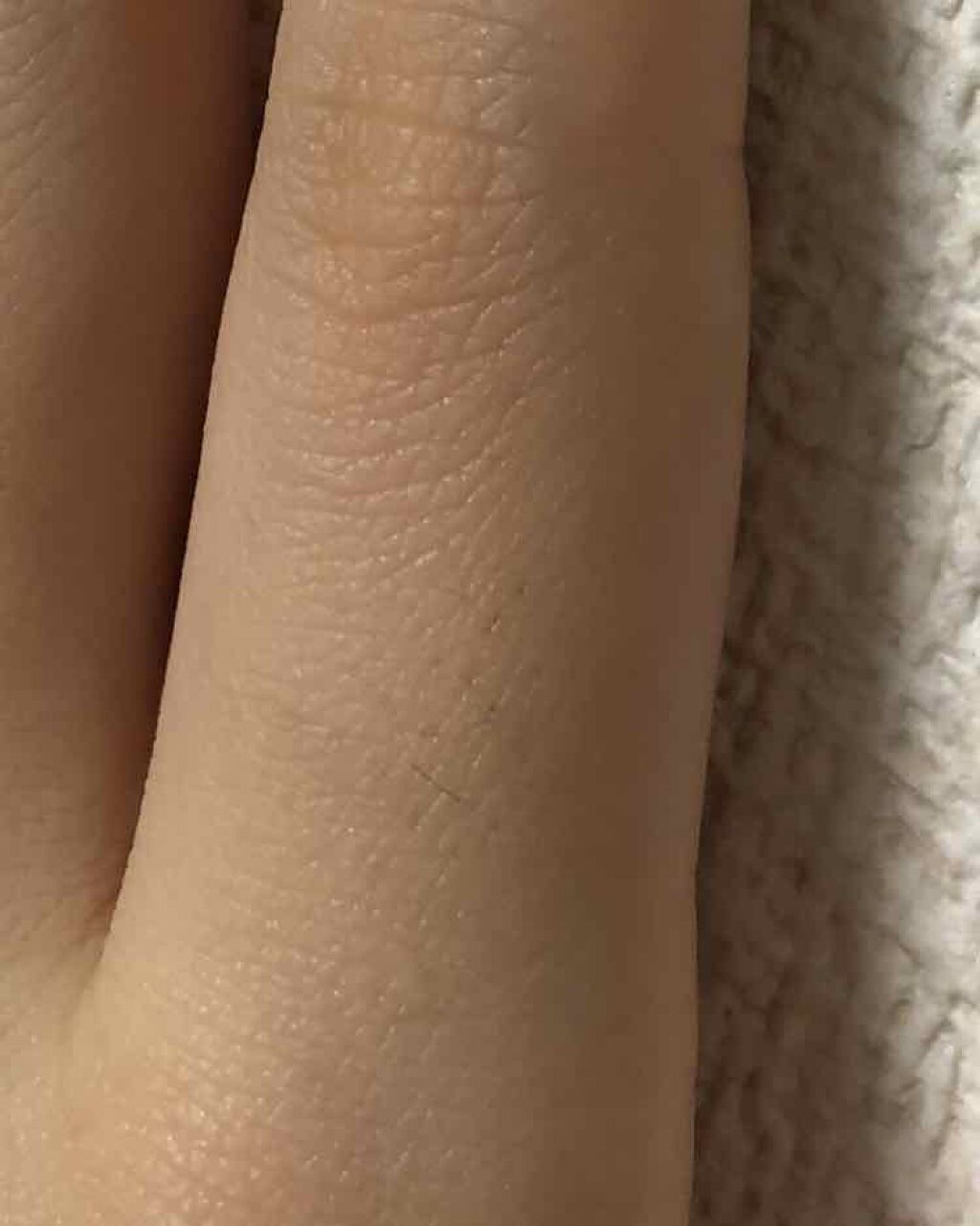 FASIZ607C IPL光脱毛器/FASIZ/家庭用脱毛器を使ったクチコミ(2枚目)