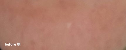 ミラミックス/ZO Skin Health/フェイスクリームを使ったクチコミ(4枚目)