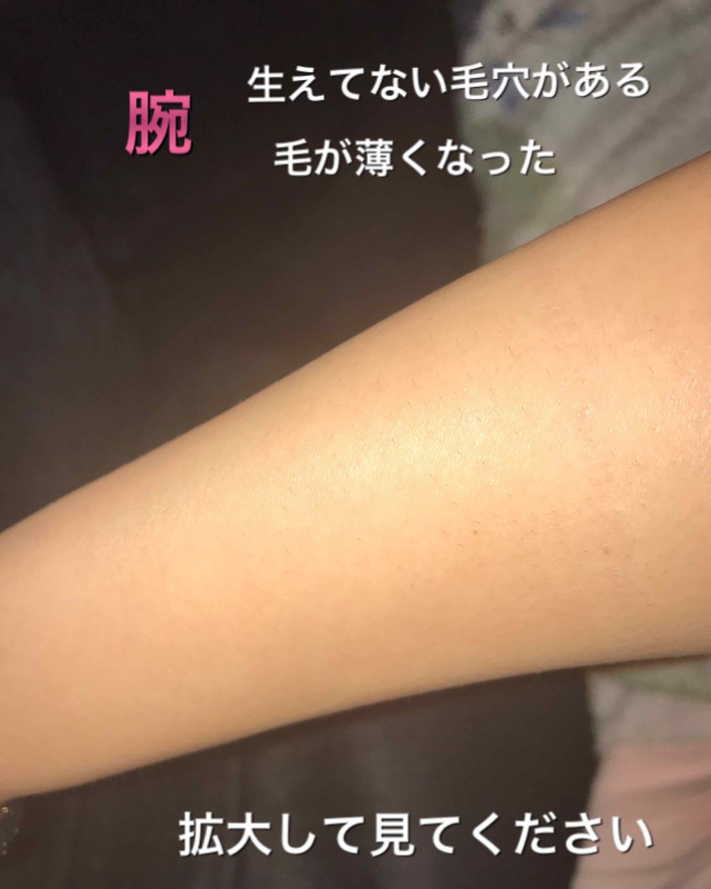 脱毛クリーム MOOMO/自然化粧品研究所/除毛クリームを使ったクチコミ(2枚目)