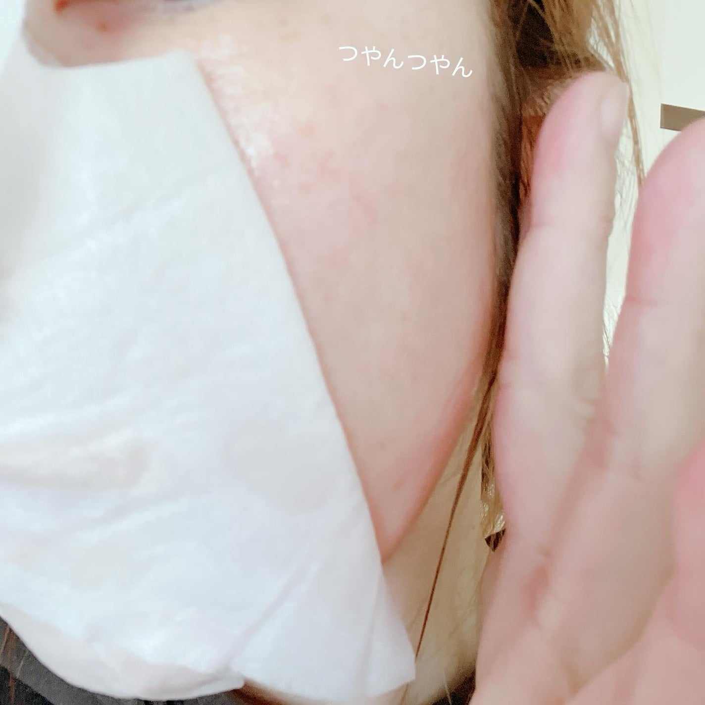 PDRNシカアンプルマスク/derDM/シートマスク・パックを使ったクチコミ(5枚目)