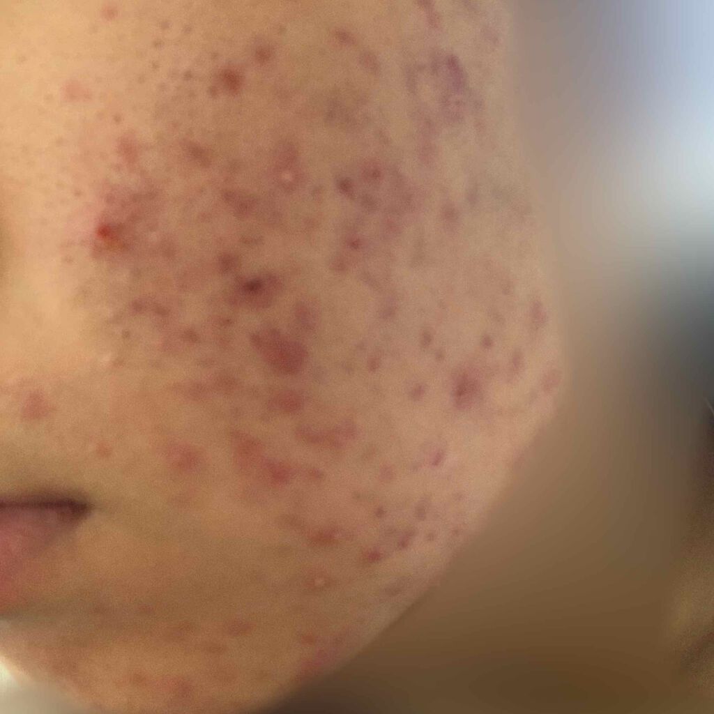 ワンステップオリジナルクリアパッド/COSRX/トナーパッドを使ったクチコミ（2枚目）