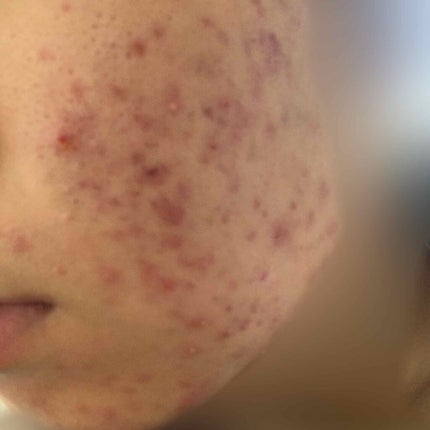 インビジブルピーリングブースターエッセンス/CNP Laboratory/ブースター・導入液を使ったクチコミ(2枚目)