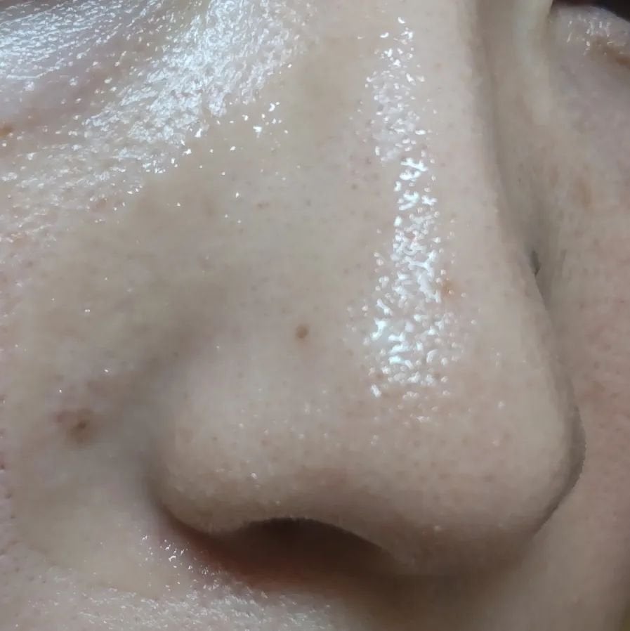 nangokudiver on LIPS 「剥がすタイプのシミ取りパック【レディブラン薬用美白ハイドロキー..」(4枚目)