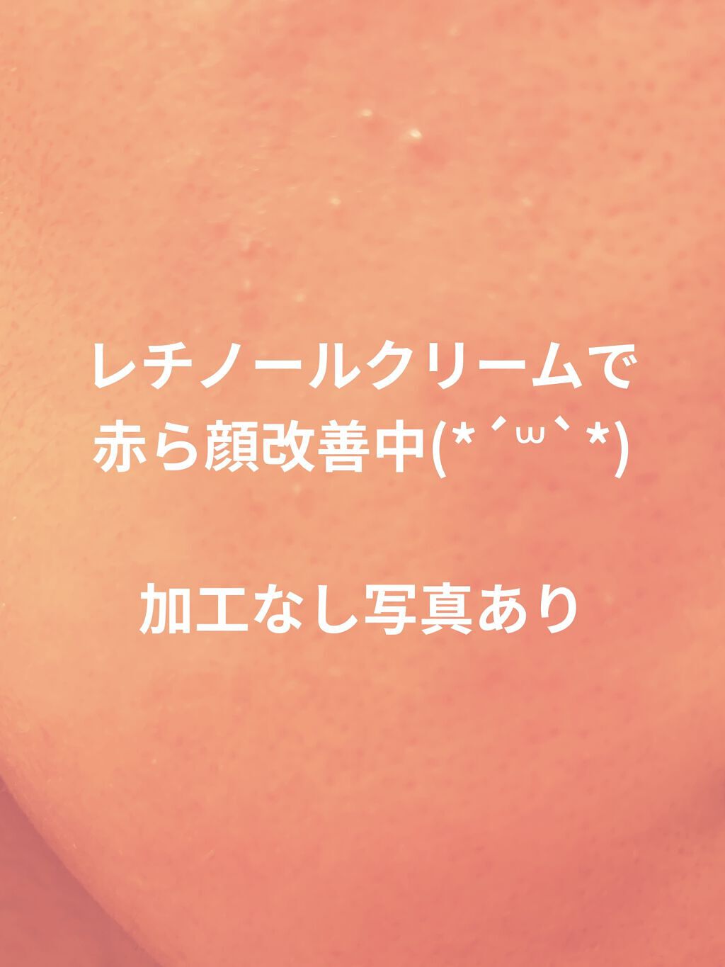 ドクダミ 77 スージングトナー/Anua/化粧水を使ったクチコミ（1枚目）