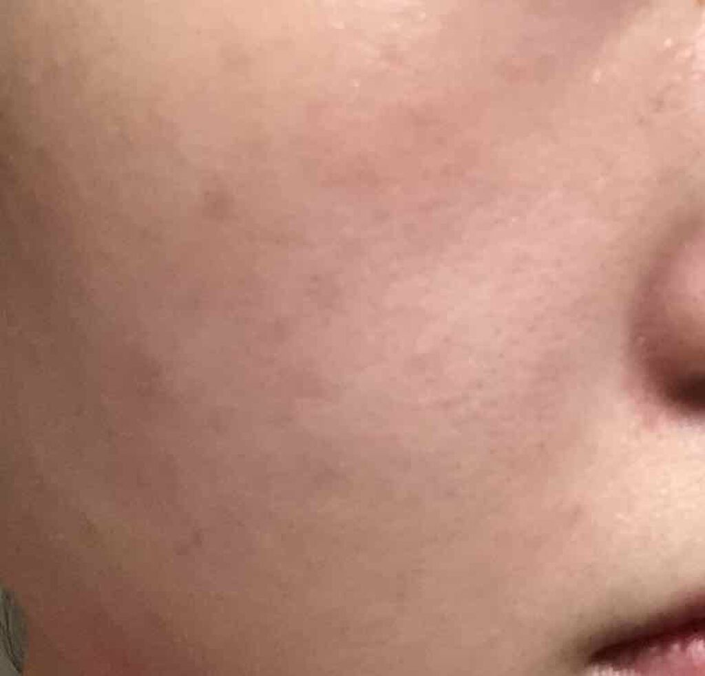 モイスチャライジングセラム/エトヴォス/美容液を使ったクチコミ(4枚目)