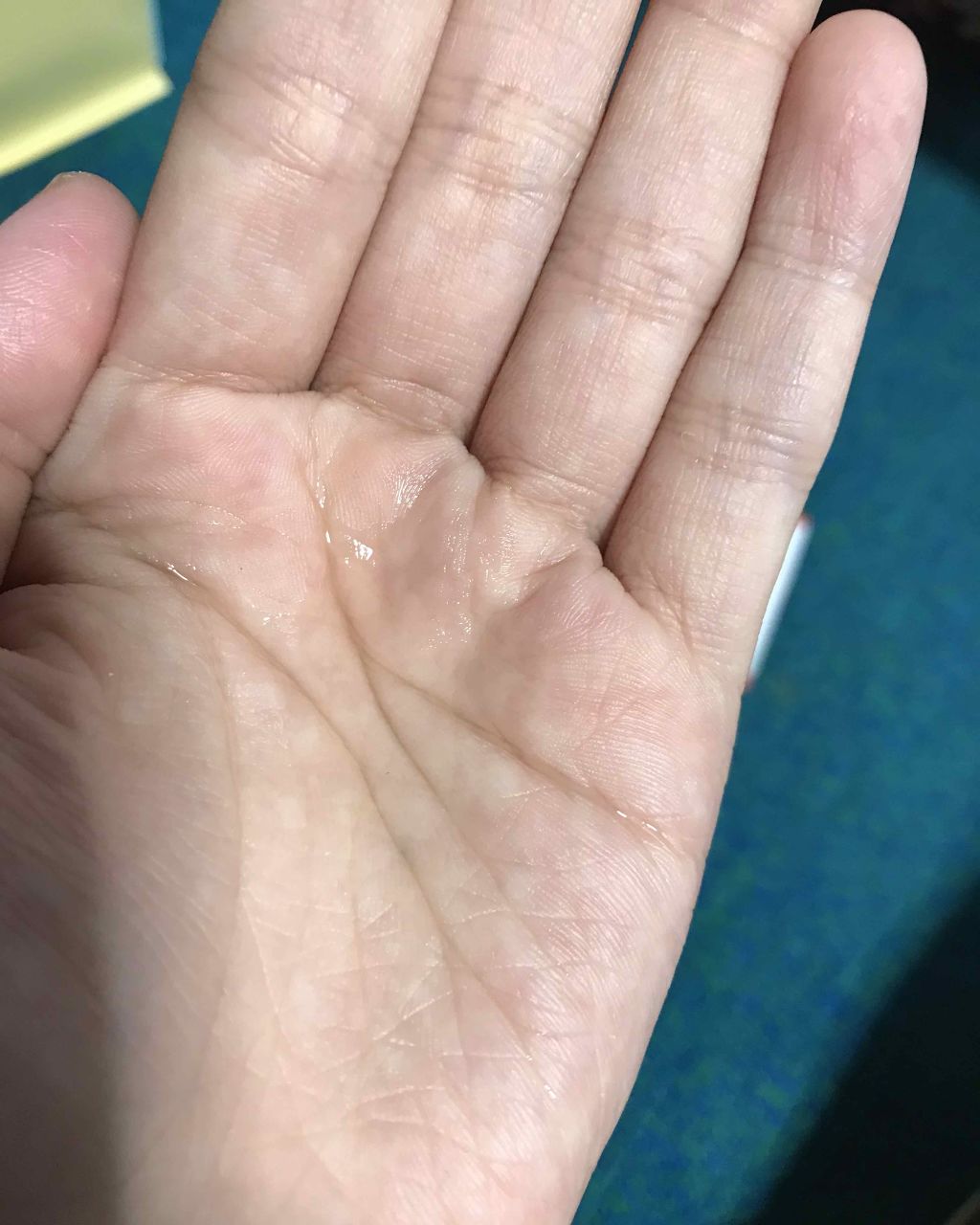 VCスターターセット/VCシリーズ/スキンケアキットを使ったクチコミ(2枚目)