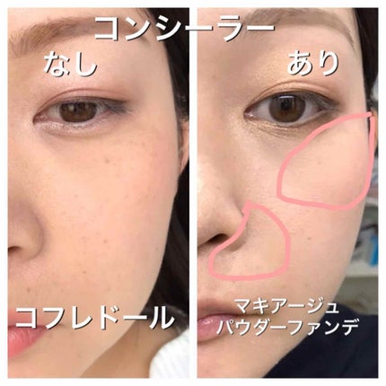 リフォルムグロウ リクイドUV/コフレドール/リキッドファンデーションを使ったクチコミ(4枚目)
