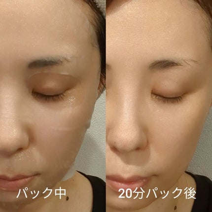 シカアルブチンマスク/NOWATER/シートマスク・パックを使ったクチコミ(3枚目)