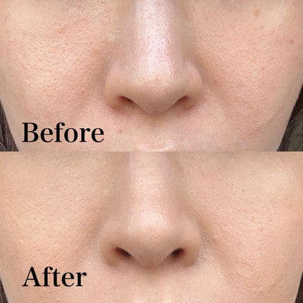 GGマルチコンシーラー/gesgep/リキッドコンシーラーを使ったクチコミ(5枚目)