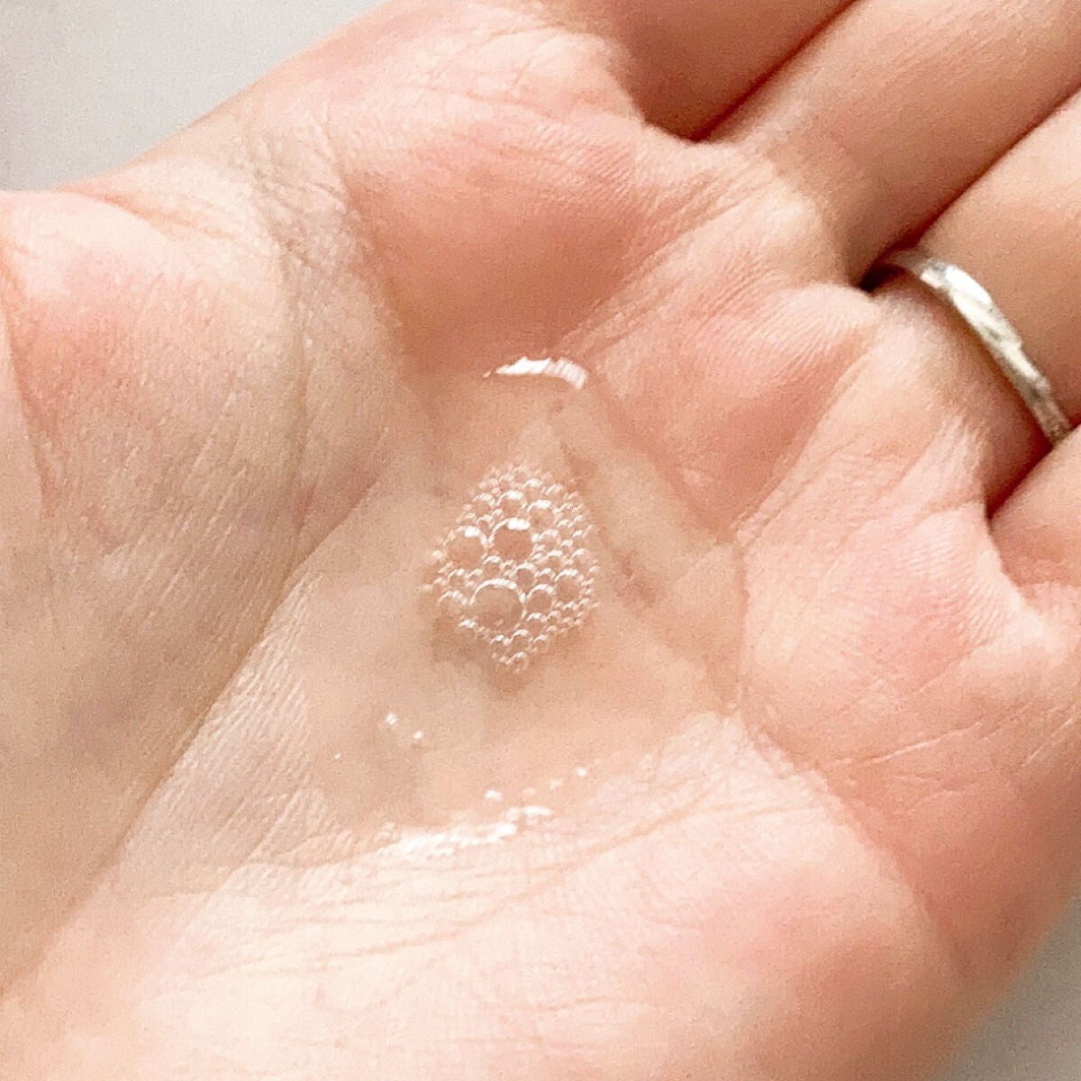 カルテHD バランスケア ローション/カルテHD/化粧水を使ったクチコミ(4枚目)