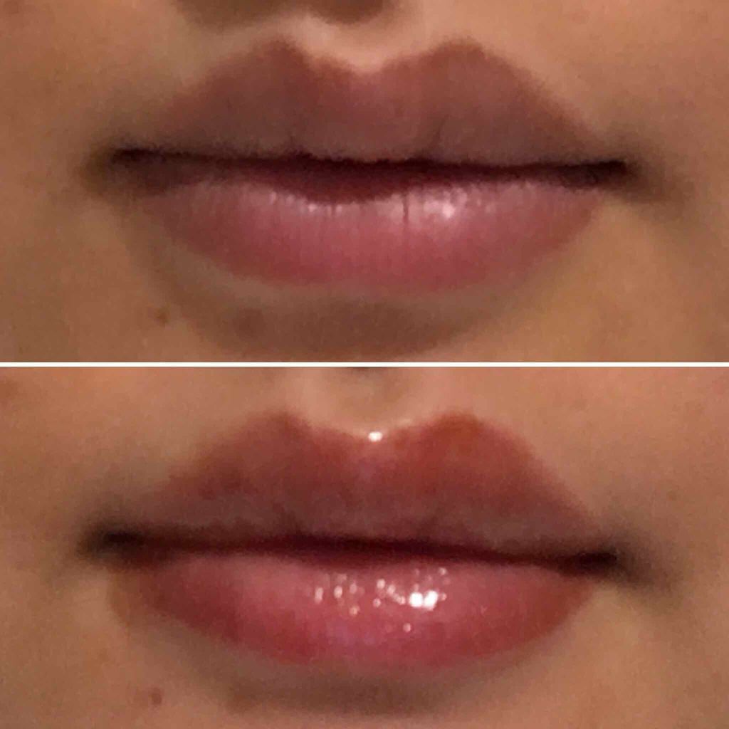 38°C / 99°F リップトリートメント (リップ美容液)/UZU BY FLOWFUSHI/リップケアを使ったクチコミ（2枚目）