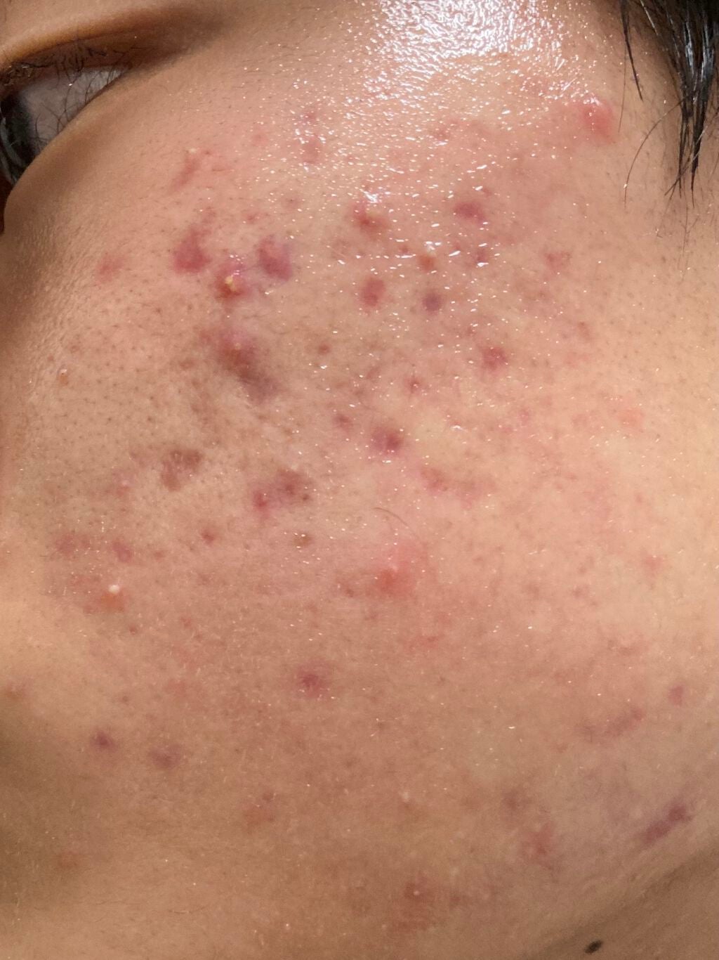 白色ワセリン(医薬品)/健栄製薬/その他を使ったクチコミ(3枚目)