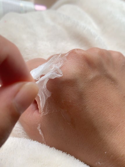 エクソソーム ペプチド グロウ パック/BloomAge/美容液を使ったクチコミ(6枚目)