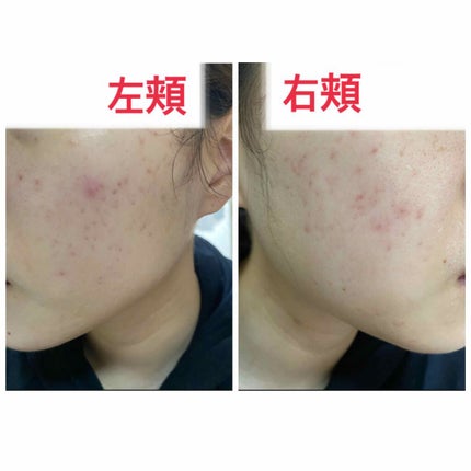 ウォッシャブル コールド クリーム/ちふれ/クレンジングクリームを使ったクチコミ(3枚目)