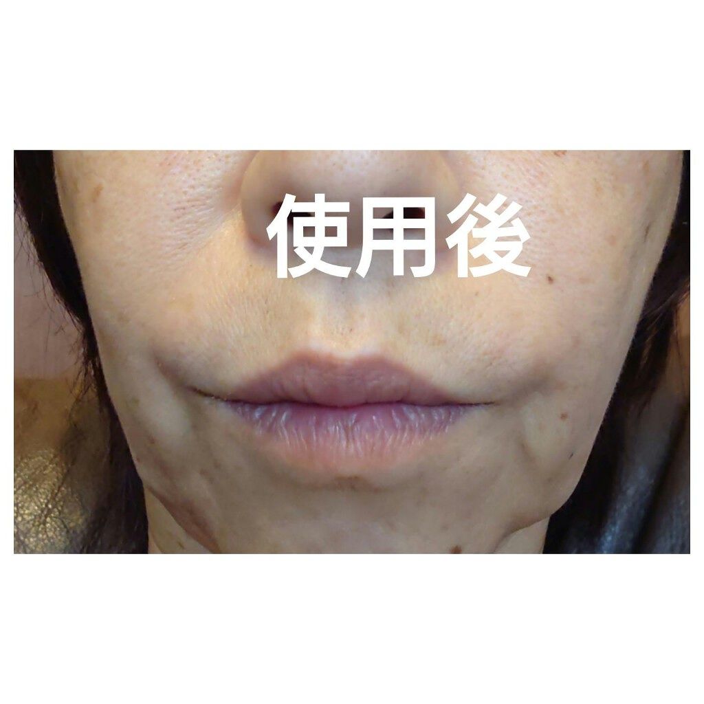 ヒアロディープパッチ/北の快適工房/シートマスク・パックを使ったクチコミ(3枚目)