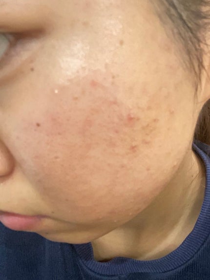 orange_blush_gxo on LIPS 「閲覧注意⚠️投稿サボりがちでした😵💫😵💫保湿クリーム変えて..」(2枚目)