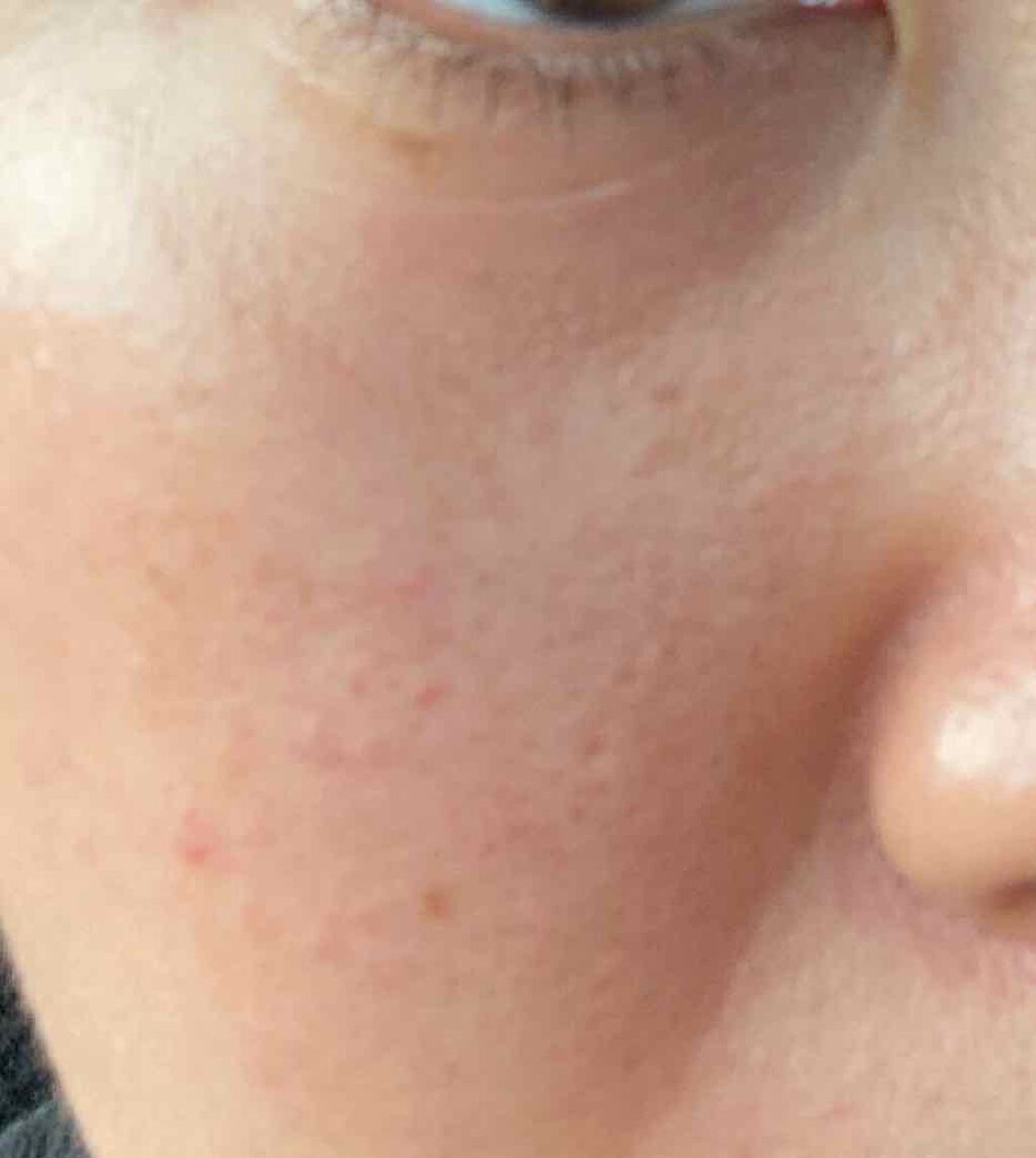 ハトムギ化粧水(ナチュリエ スキンコンディショナー R )/ナチュリエ/化粧水を使ったクチコミ(2枚目)