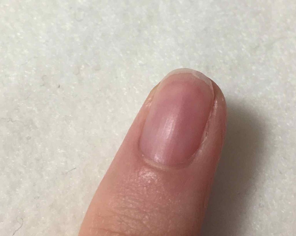 エテュセ クイックケアコート/ettusais/ネイルオイル・トリートメントを使ったクチコミ(2枚目)