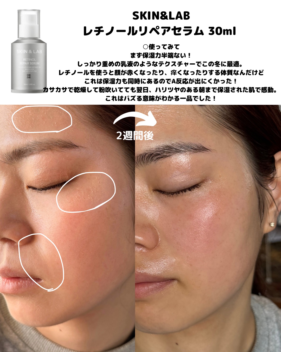 ヴィーガン バクチオールアイセラム/SKIN&LAB/アイケア・アイクリームを使ったクチコミ（3枚目）