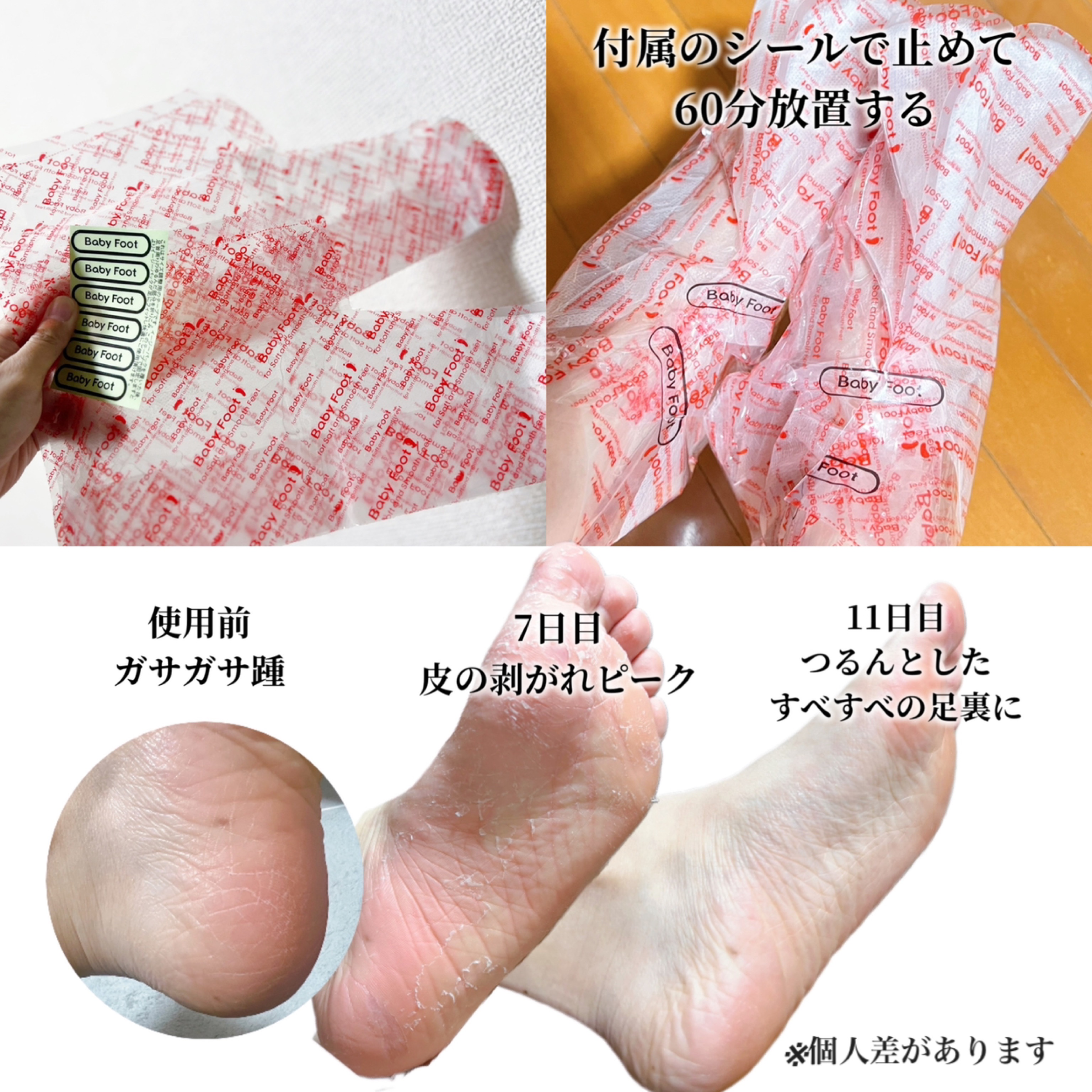 イージーパックDP60分タイプ 摘みたていちごの香り/ベビーフット/レッグ・フットケアを使ったクチコミ（2枚目）