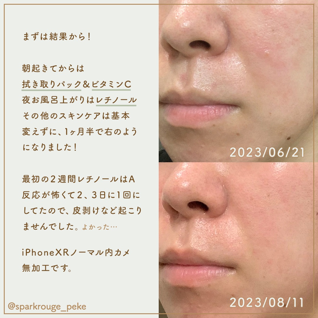 毛穴フォーカスVC VC3エッセンス/pdc/美容液を使ったクチコミ（3枚目）