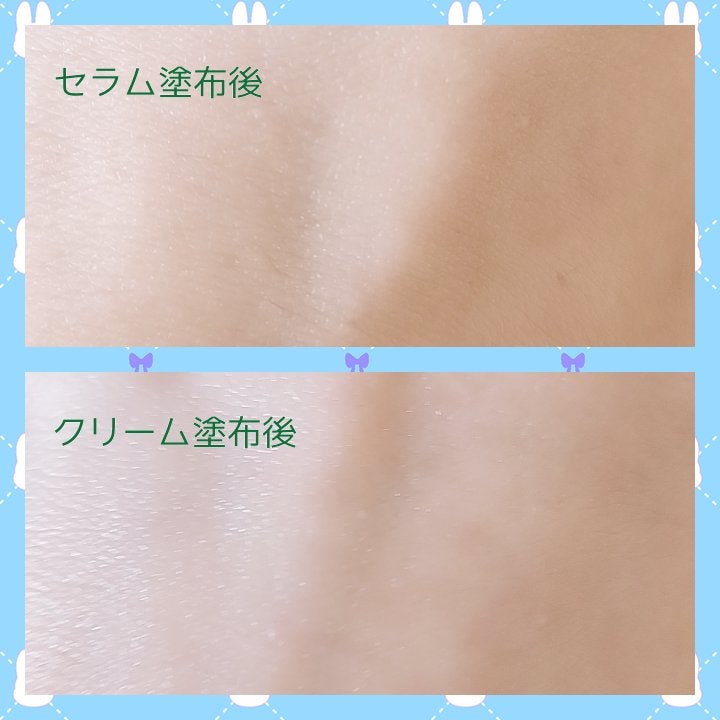 リコリス ブレミッシュ カーミングセラム/rooTree/美容液を使ったクチコミ(6枚目)