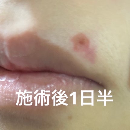 を使ったクチコミ(3枚目)