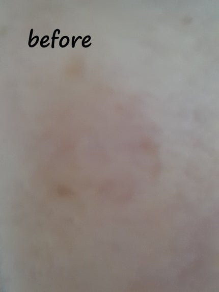 アイレノールすっぴんクリーム/IRENOL/クリームコンシーラーを使ったクチコミ(5枚目)