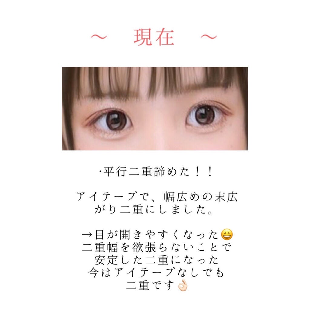 ナイトアイボーテ/StreeTrend/二重まぶた用アイテムを使ったクチコミ(5枚目)