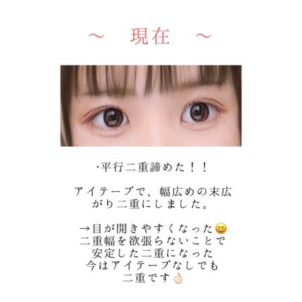 ナイトアイボーテ/StreeTrend/二重まぶた用アイテムを使ったクチコミ(5枚目)