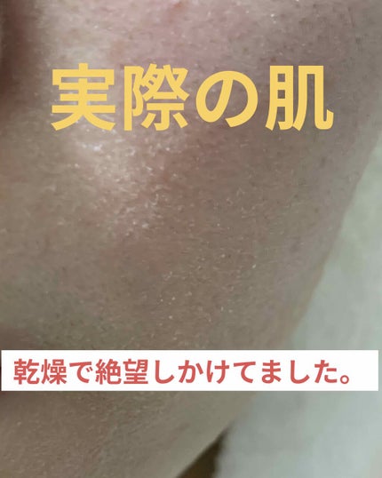 アレッポの石鹸<ノーマル>/アレッポの石鹸/洗顔石鹸を使ったクチコミ(1枚目)