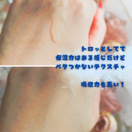 アクアヒアルロニックエッセンス/ロベクチン/化粧水を使ったクチコミ(2枚目)