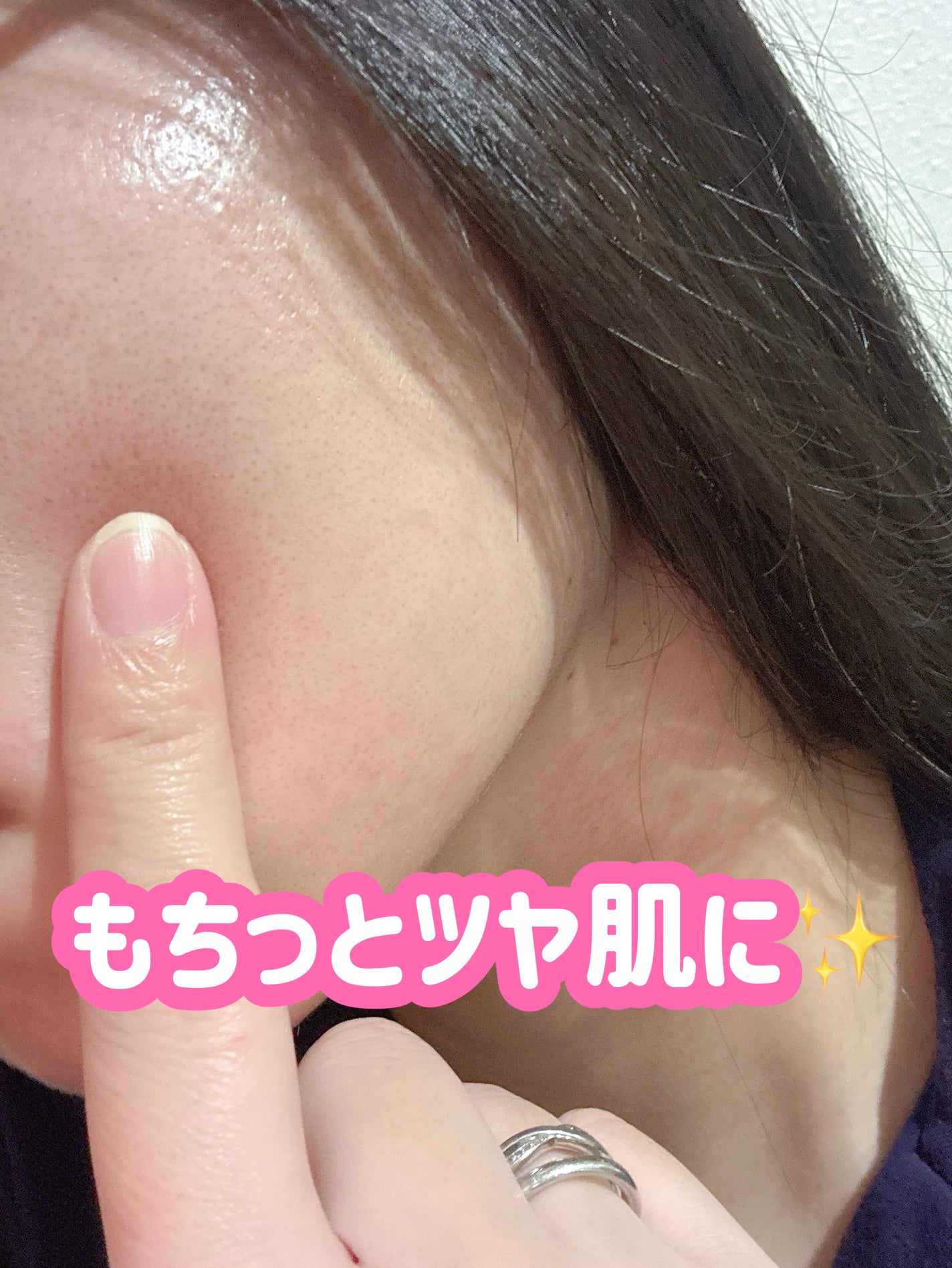PDRNピンクアンプル PDRN 10,000ppm配合/MEDICUBE/美容液を使ったクチコミ(4枚目)