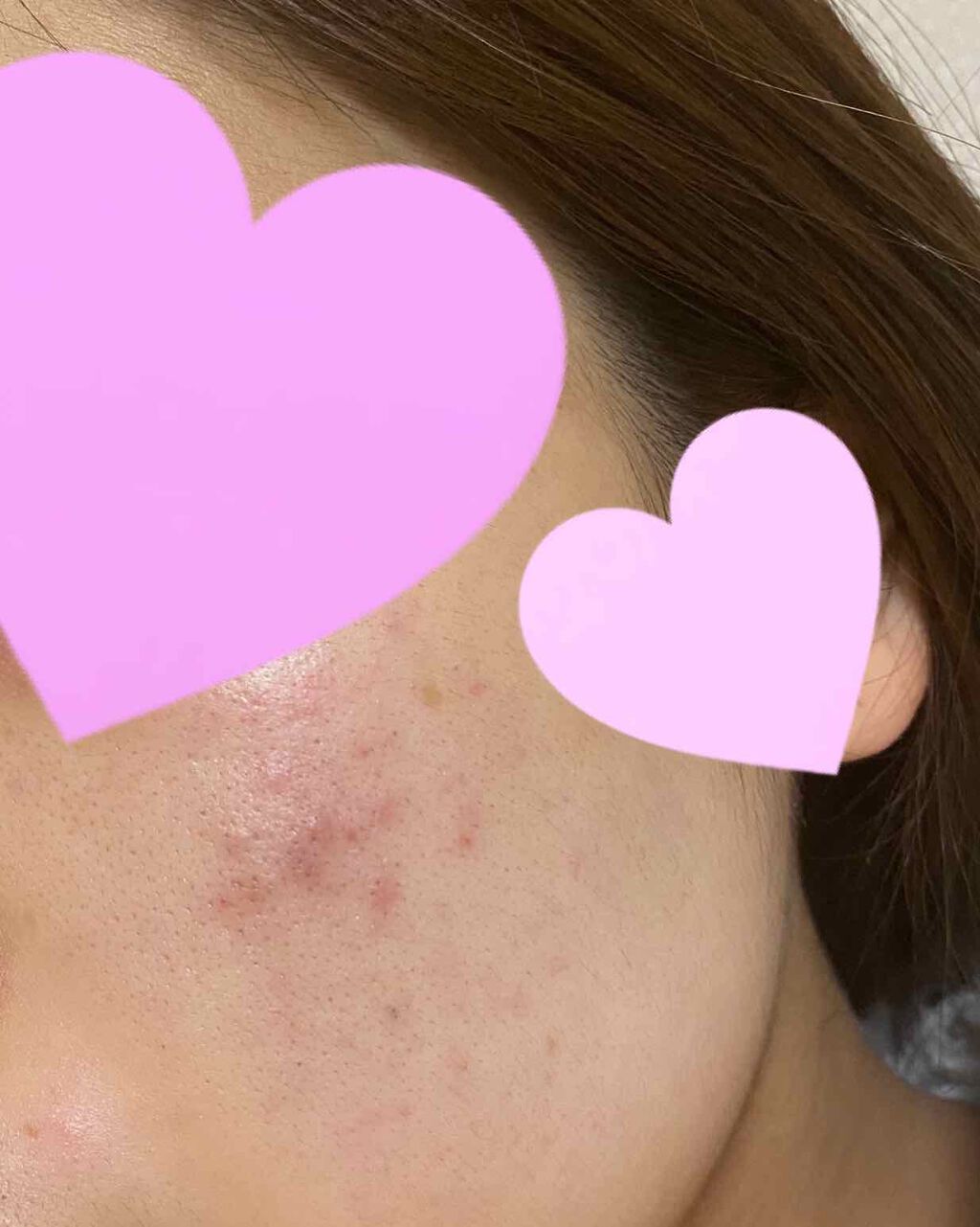 プロポリスアンプル オイルインクリーム/CNP Laboratory/フェイスクリームを使ったクチコミ(2枚目)