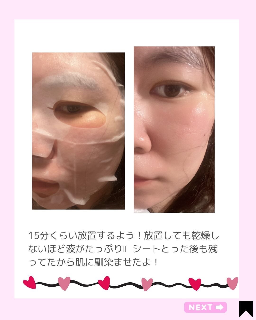 PHセンシティブマスク バイタルフィット/SAM'U/シートマスク・パックを使ったクチコミ(5枚目)