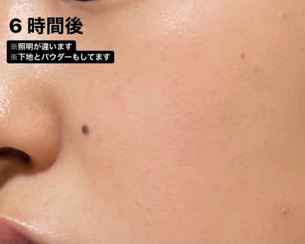 フィットミー コンシーラー/MAYBELLINE NEW YORK/リキッドコンシーラーを使ったクチコミ(6枚目)