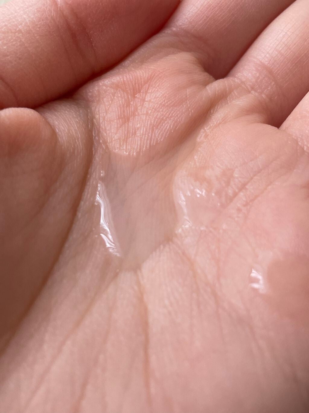 薬用化粧水/スキンライフ/化粧水を使ったクチコミ(2枚目)