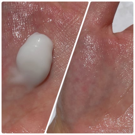 センテラ アンプル/SKIN1004/美容液を使ったクチコミ(8枚目)