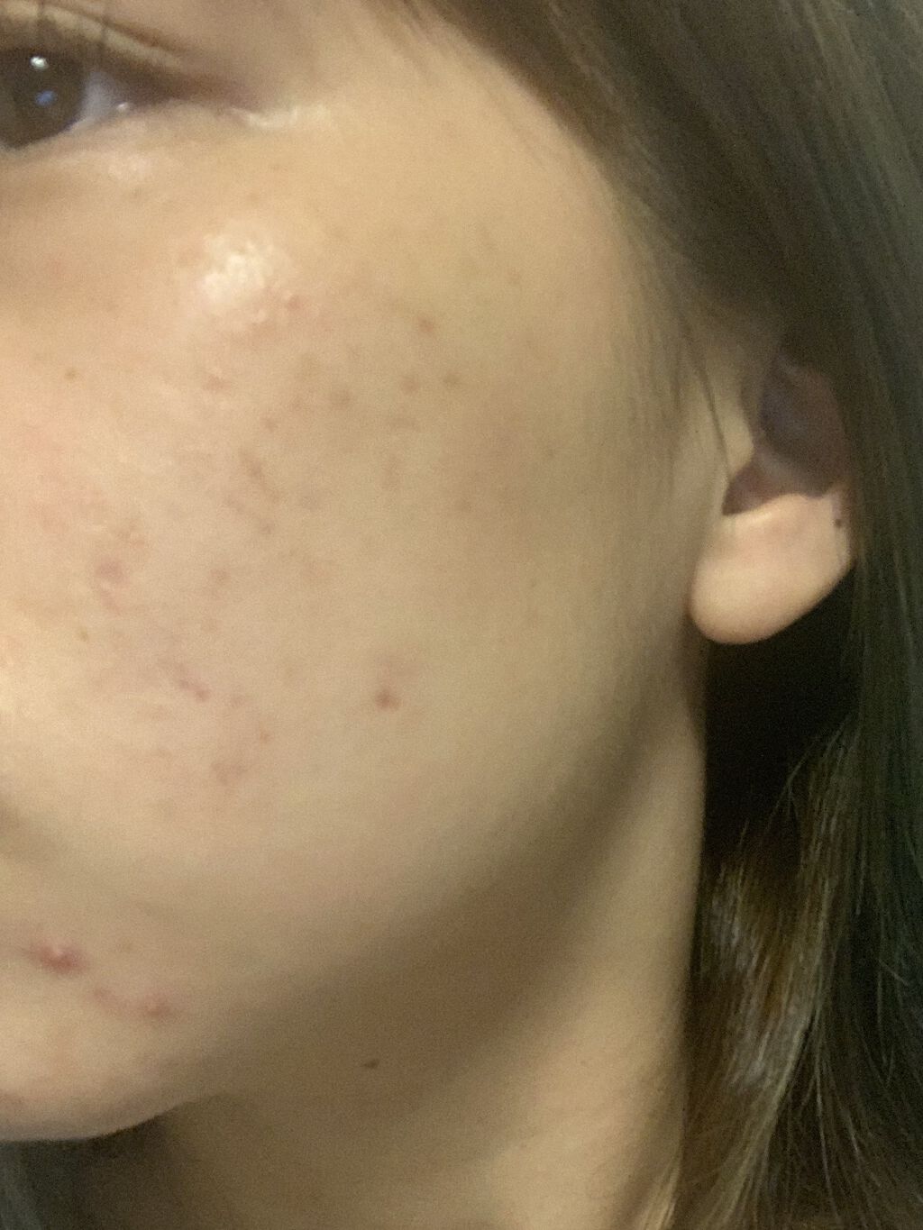 白潤 薬用美白化粧水(しっとりタイプ)/肌ラボ/化粧水を使ったクチコミ（2枚目）